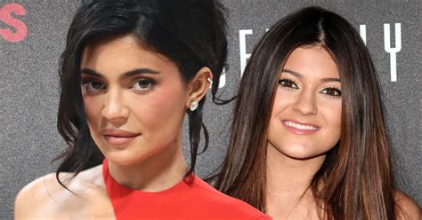 kylie vorher nachher|Kylie Jenner: So sah sie vor den Beauty